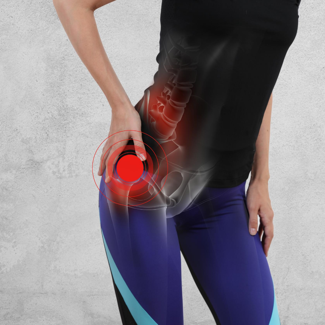 Hip Bursitis  Symptoms, Treatments, & Prevention