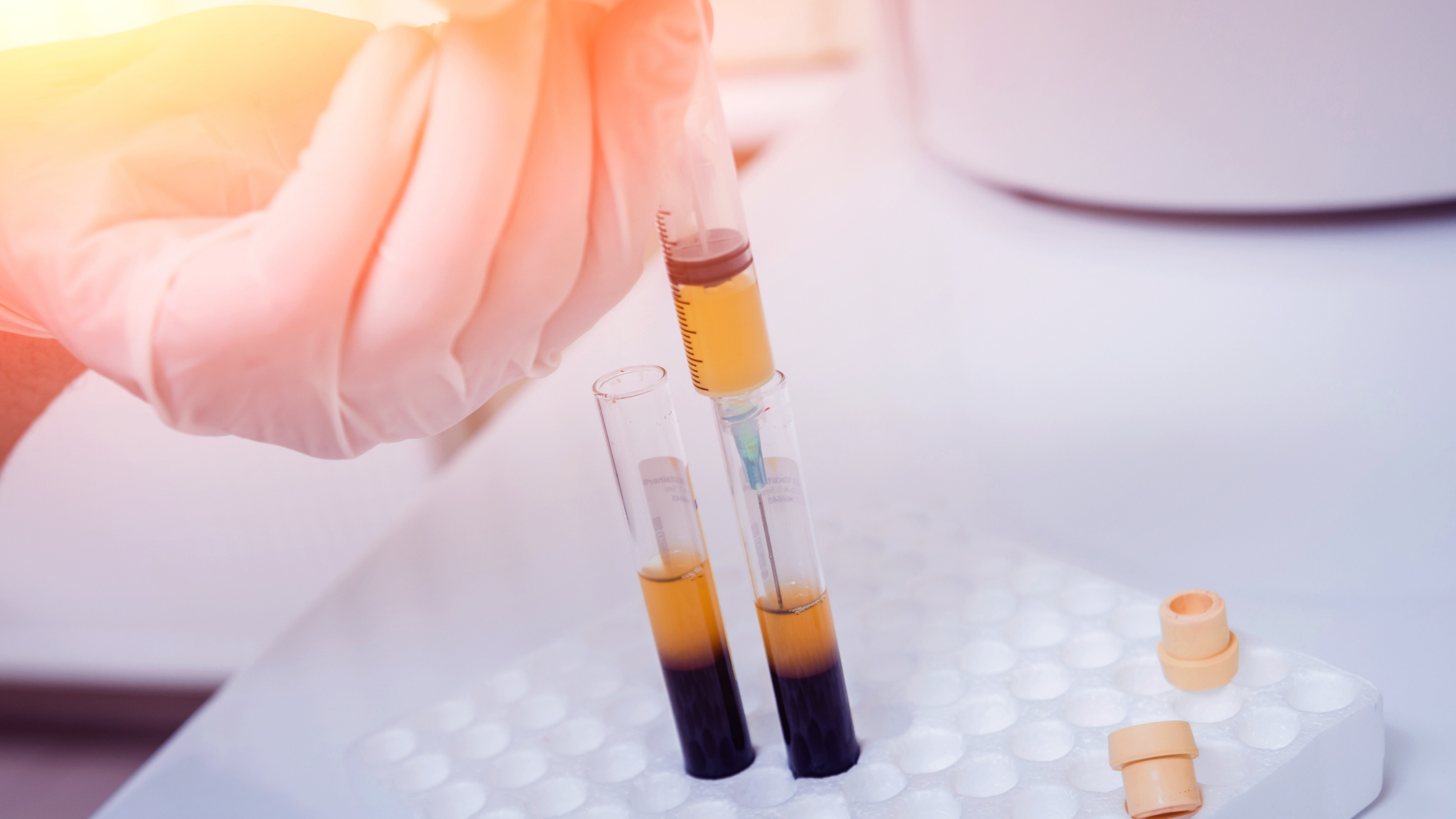 Platelet-Rich Plasma (PRP) Injection: How It Works