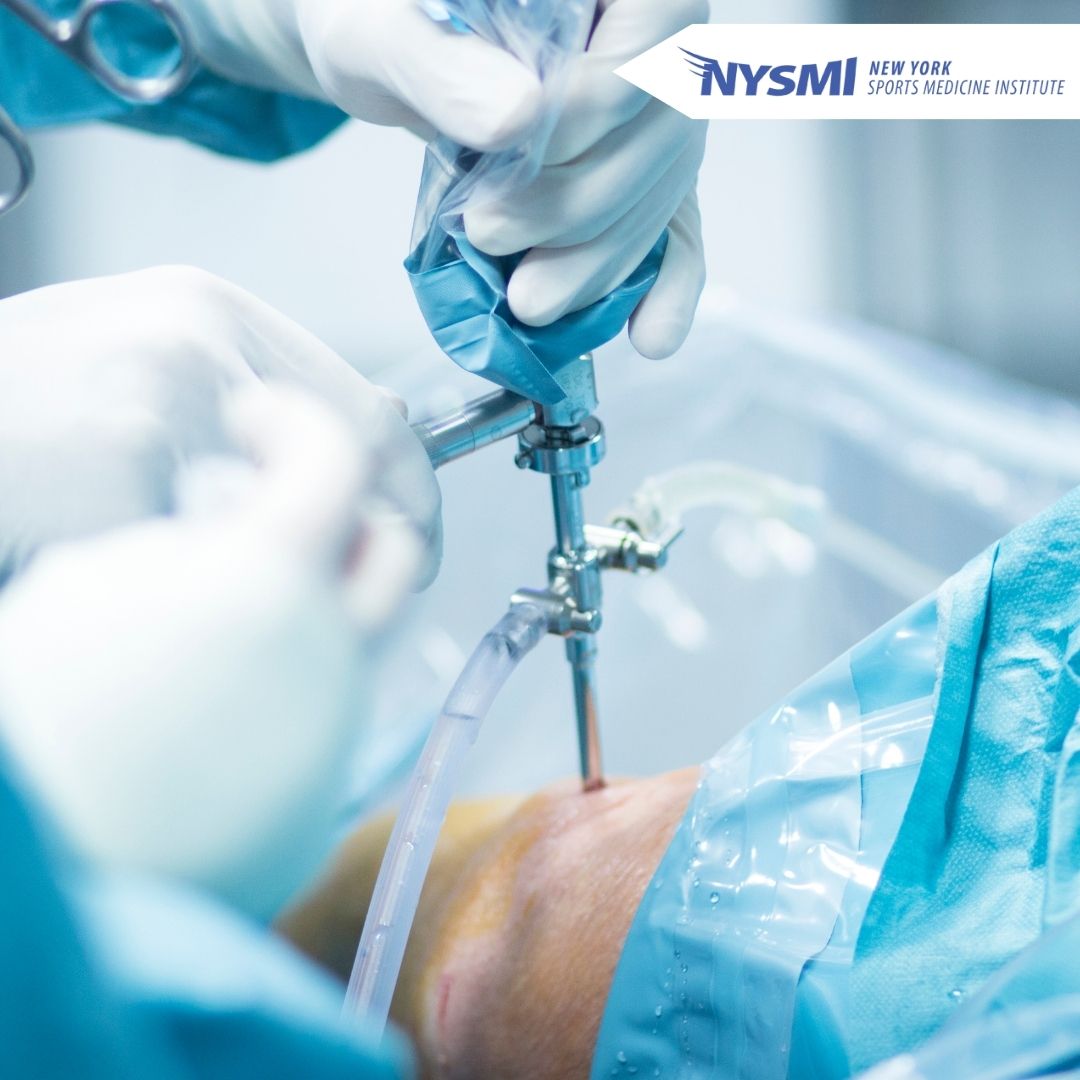 Orthopedic Blog Posts - New York Sports Medicine Institute - Dr